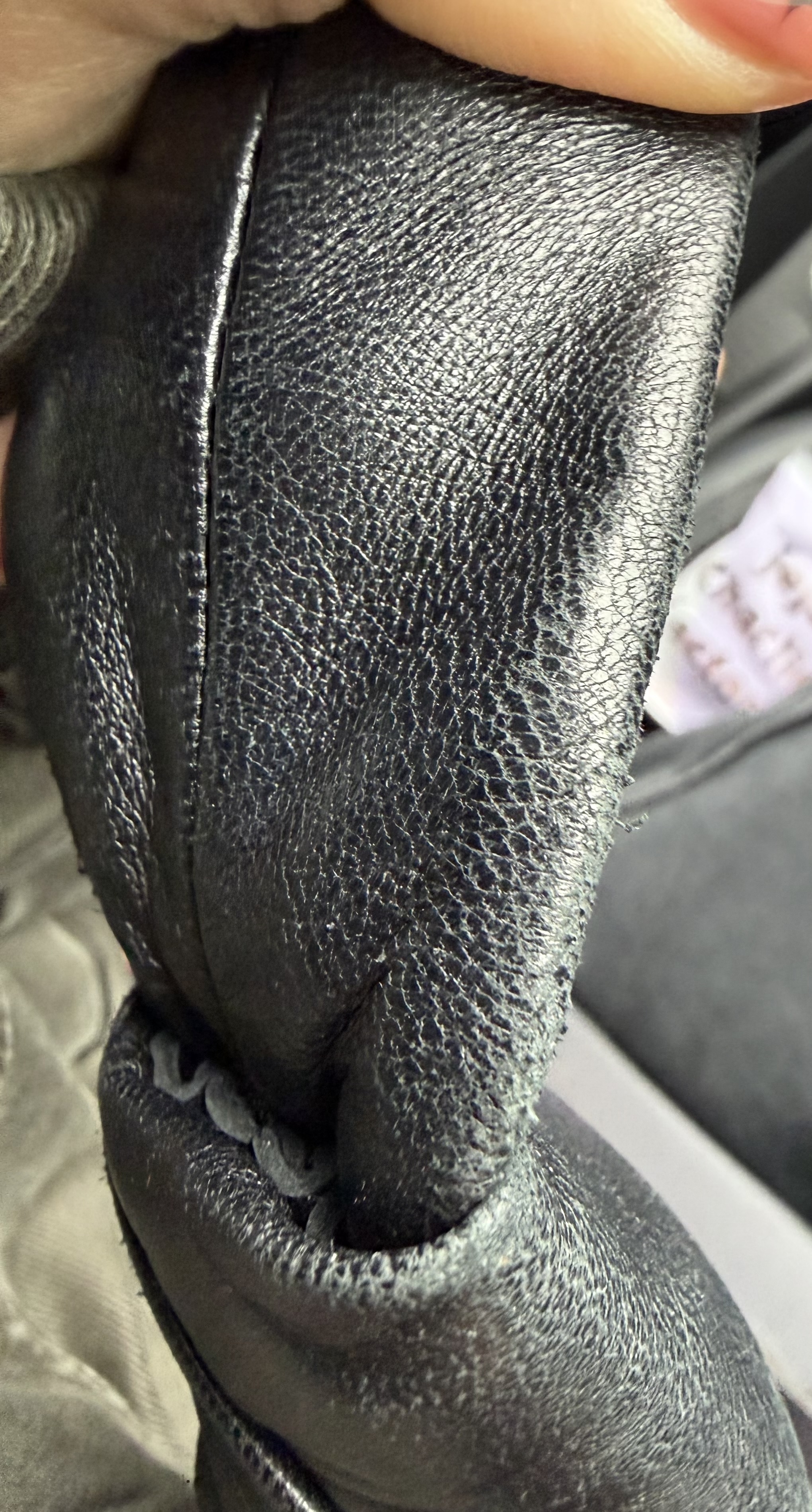 오염문의 이미지: 가죽 벗겨짐